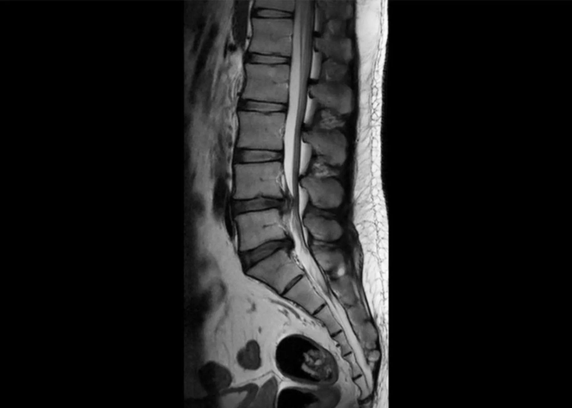 Uma retina humana com neurônios sendo reparados por pequenos pontos de luz, simbolizando aplicações futuras.