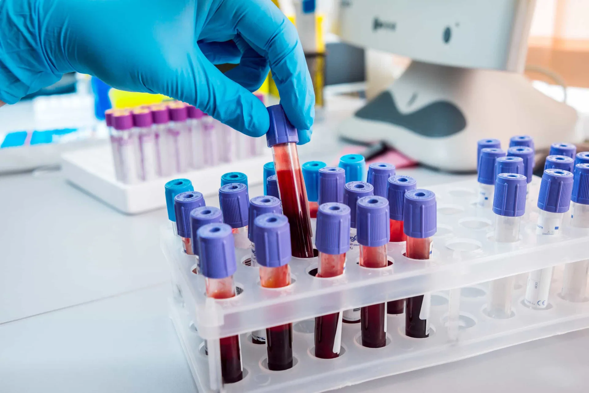 Médico analisando exames complexos de um paciente, como ressonância magnética.