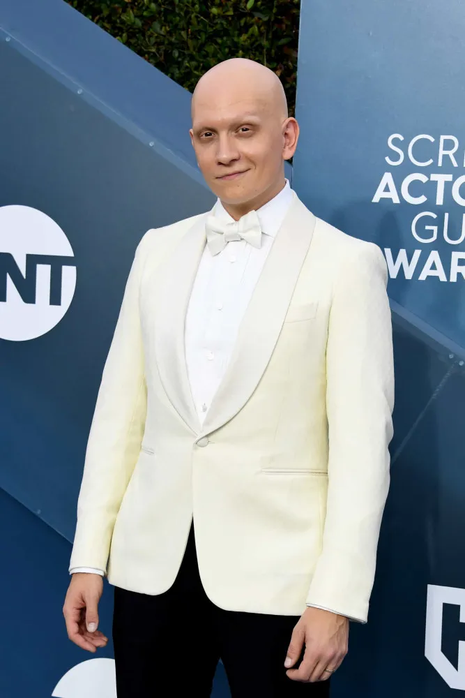 O ator Anthony Carrigan, da série 'Barry', que abraçou sua alopecia.