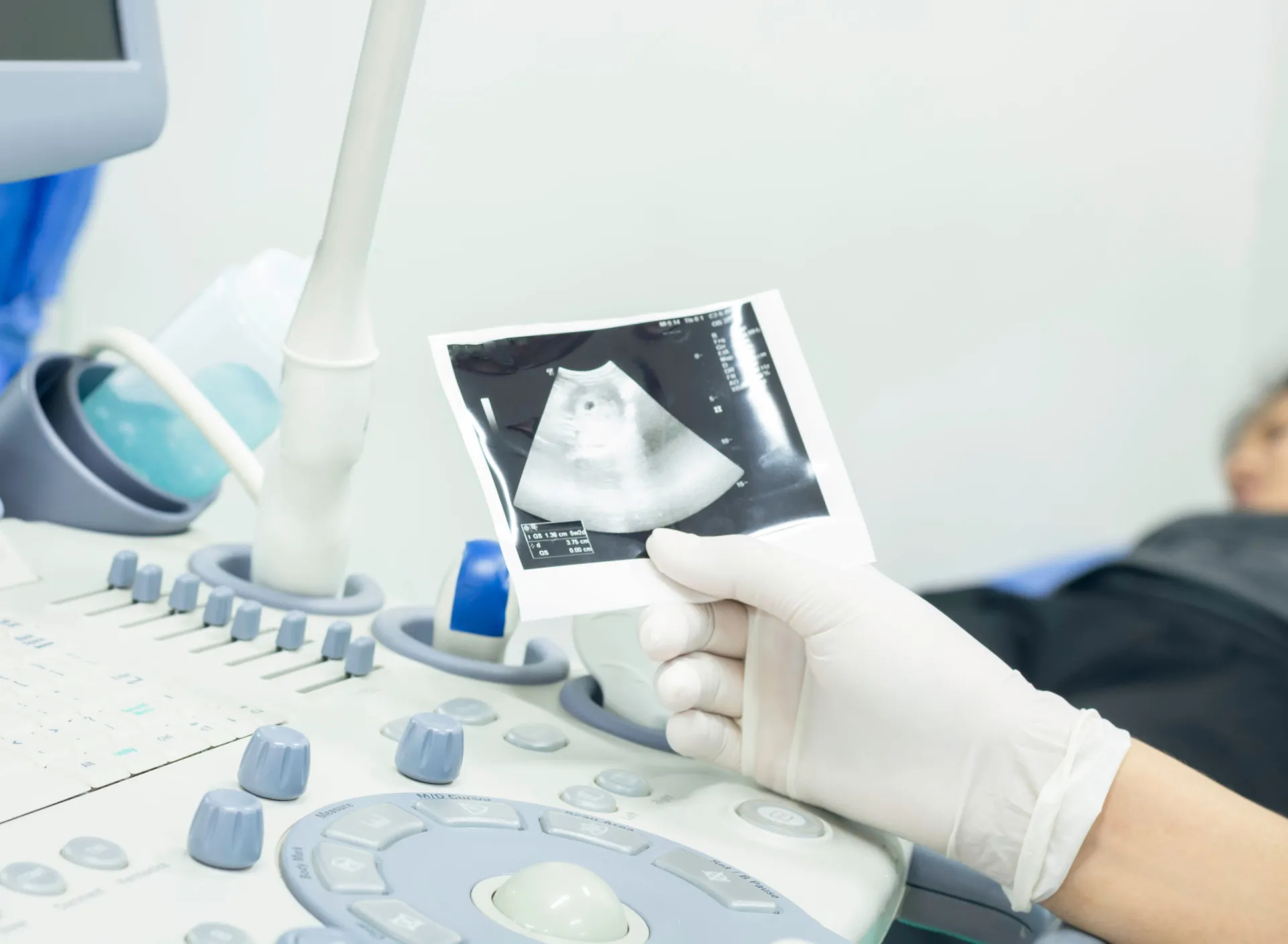 Uma placenta com aparência não saudável, ilustrando a insuficiência placentária.