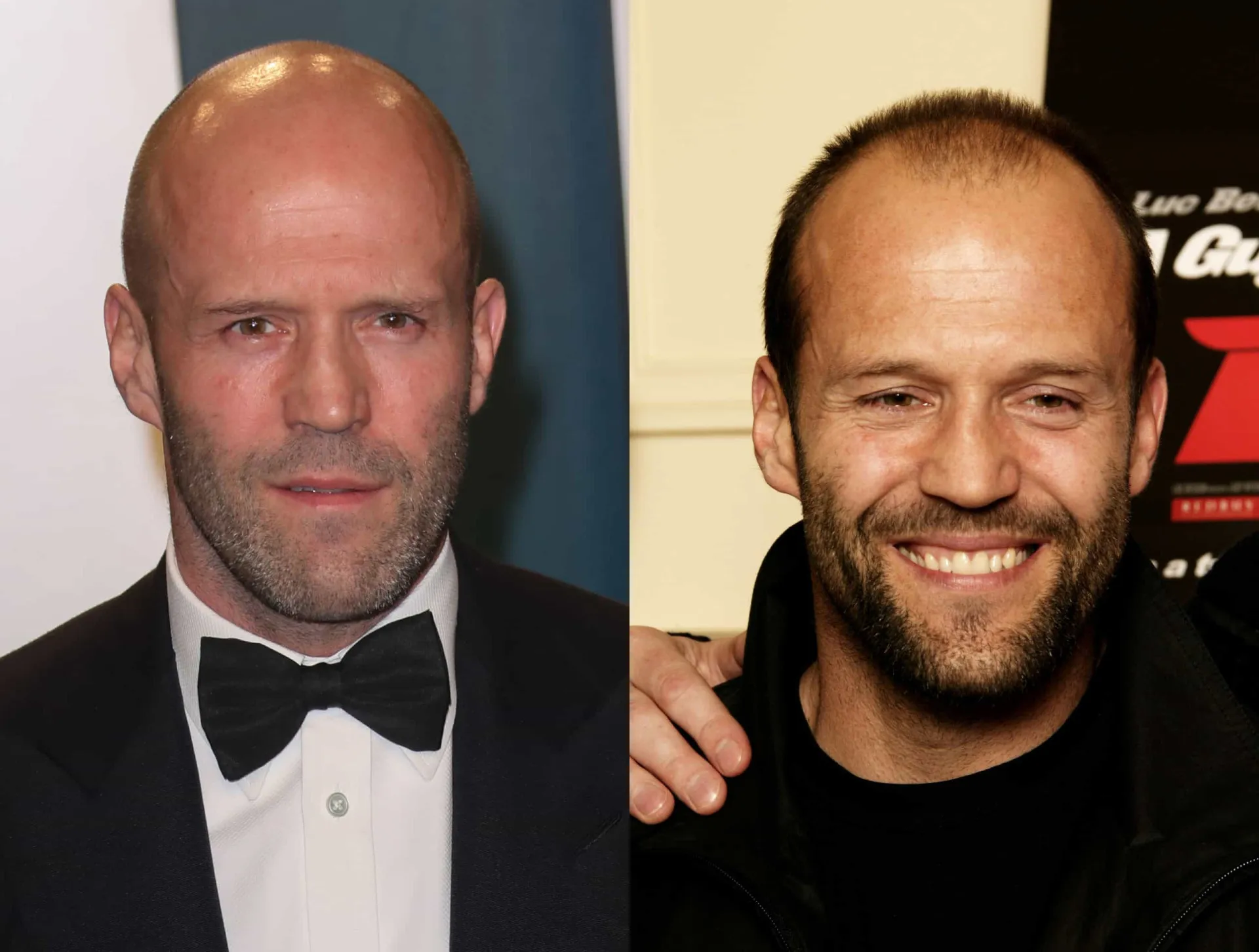 Jason Statham em duas fases: com um pouco de cabelo no início da carreira e completamente careca hoje.