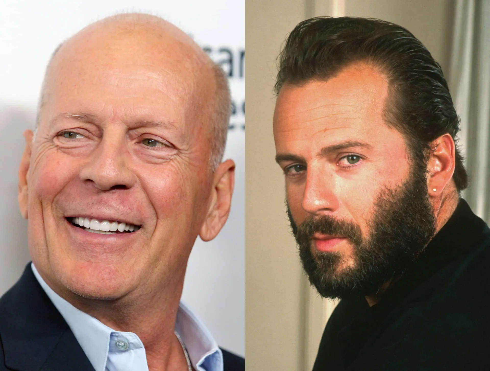 Montagem de Bruce Willis jovem com cabelo e mais velho, completamente careca.