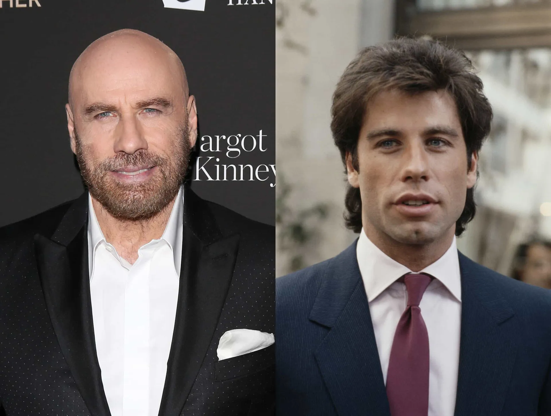John Travolta com seu famoso topete em 'Grease' e com o visual careca que adotou recentemente.