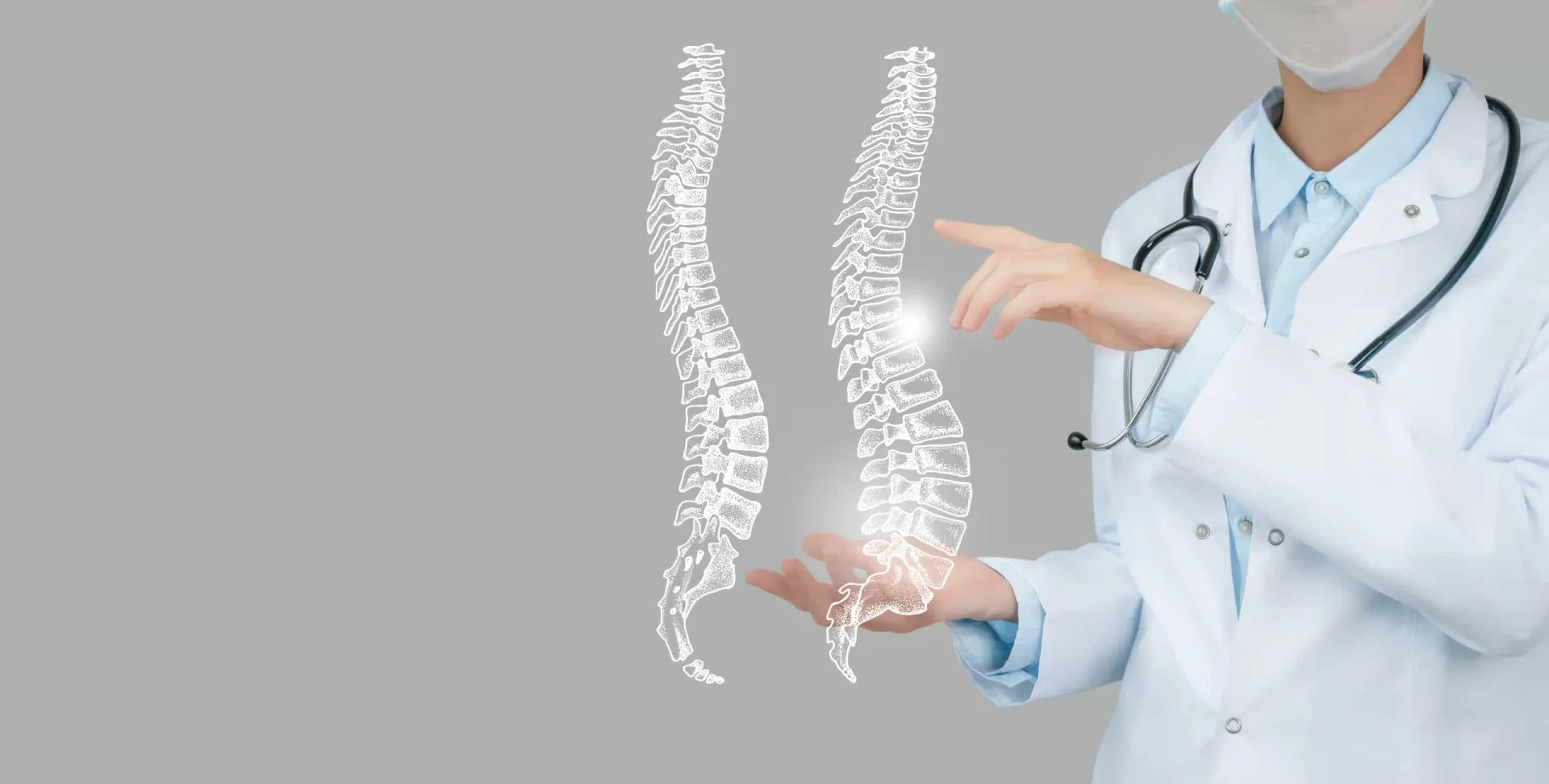 Coluna vertebral com escoliose, um problema comum no estágio 4 da Síndrome de Rett.