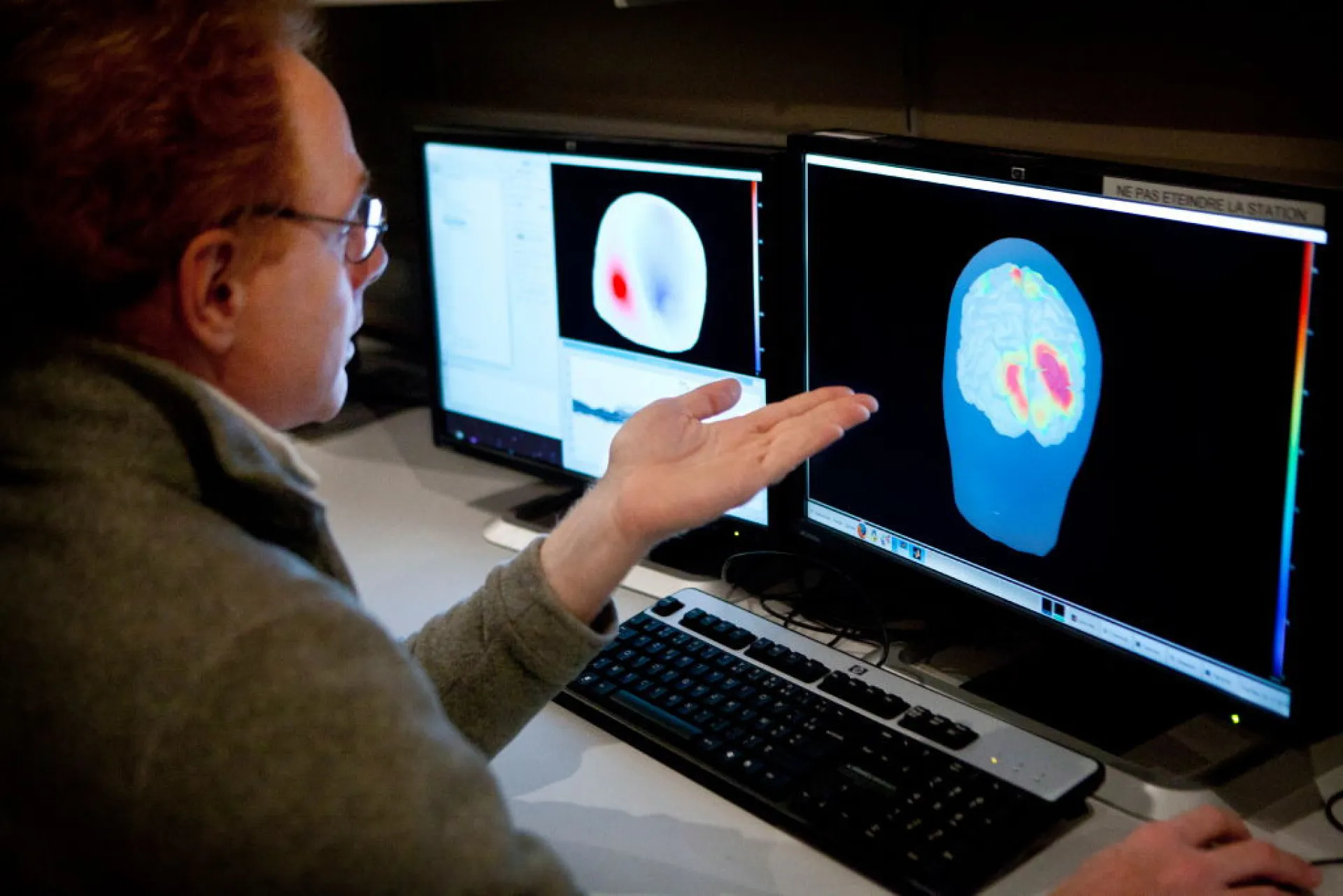 Uma imagem cerebral mostrando a atividade neural, simbolizando a luta contra o Alzheimer.