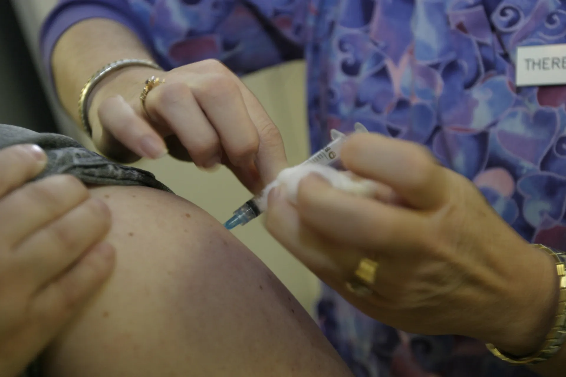 Uma lesão de carcinoma espinocelular na pele de uma pessoa.