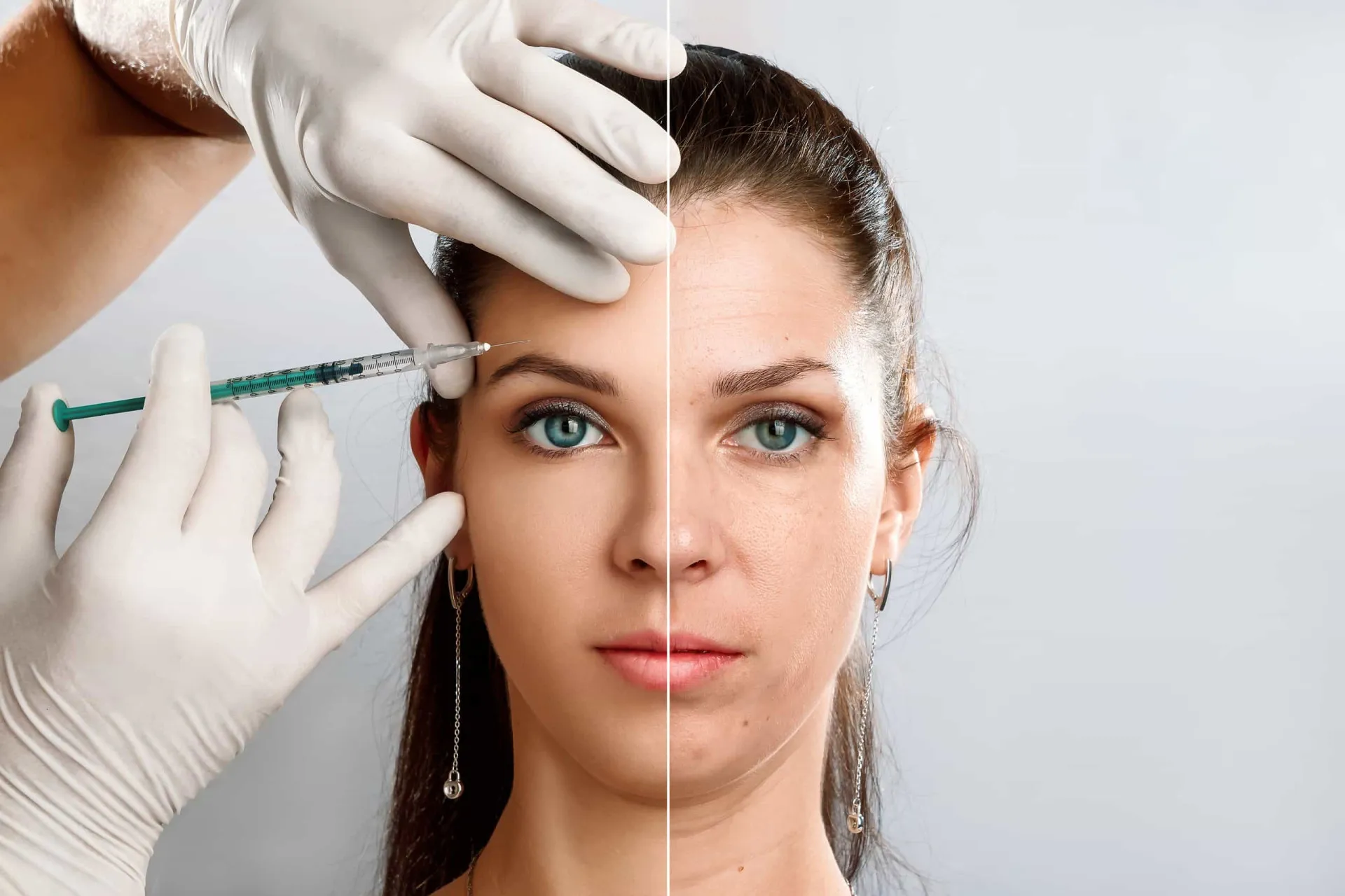 Mulher com a pele limpa e saudável, resultado de um tratamento eficaz para acne.