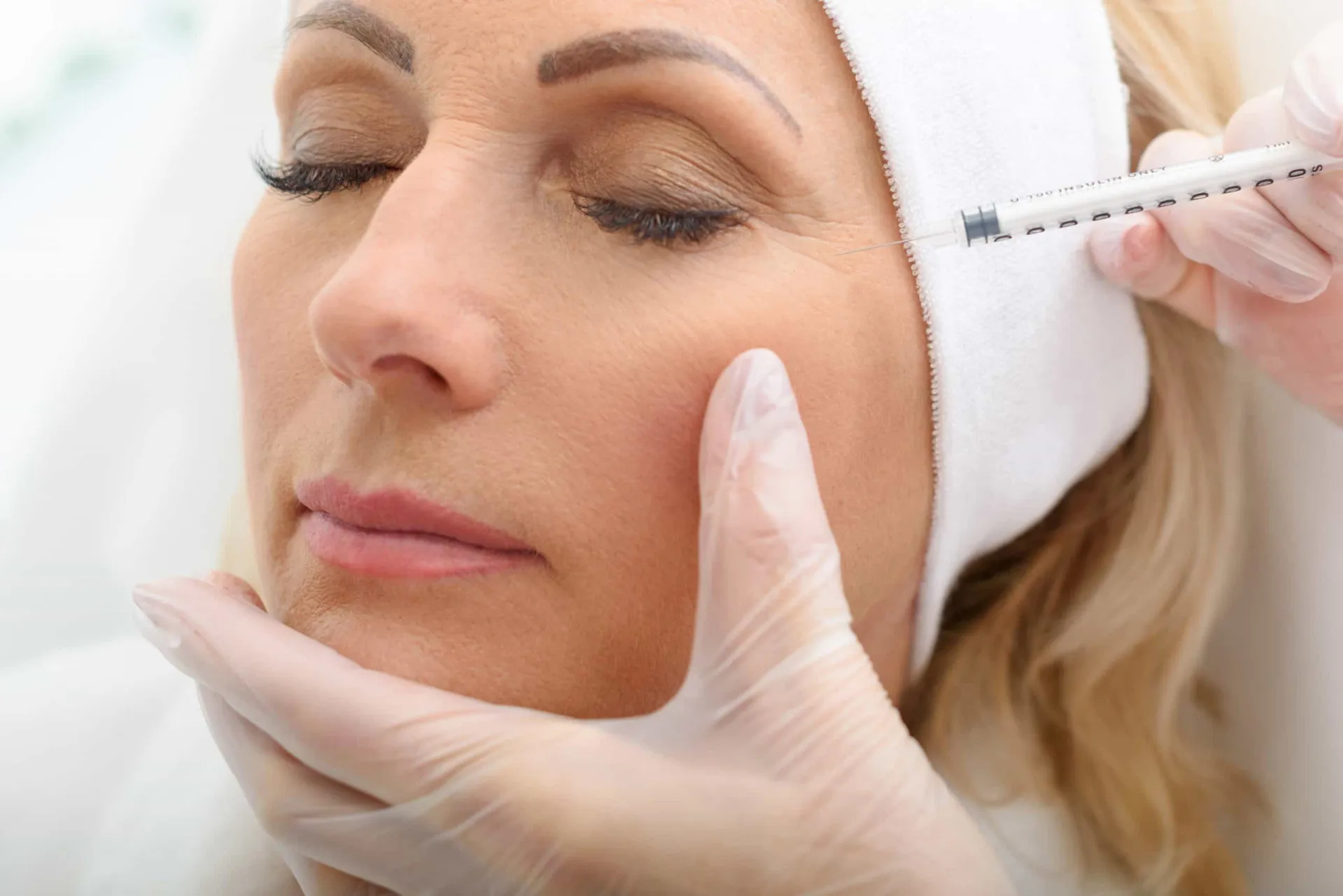 Rosto de uma mulher jovem e sorridente, representando o uso preventivo do Botox.