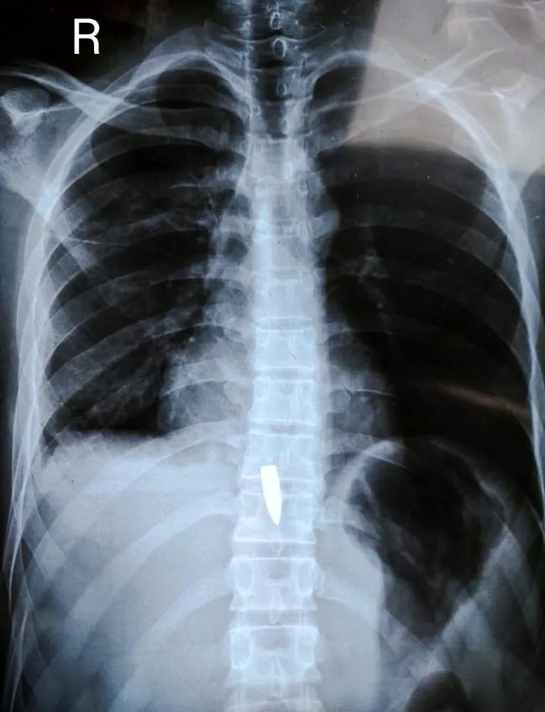 Médico analisando uma imagem de raio-x em uma tela.