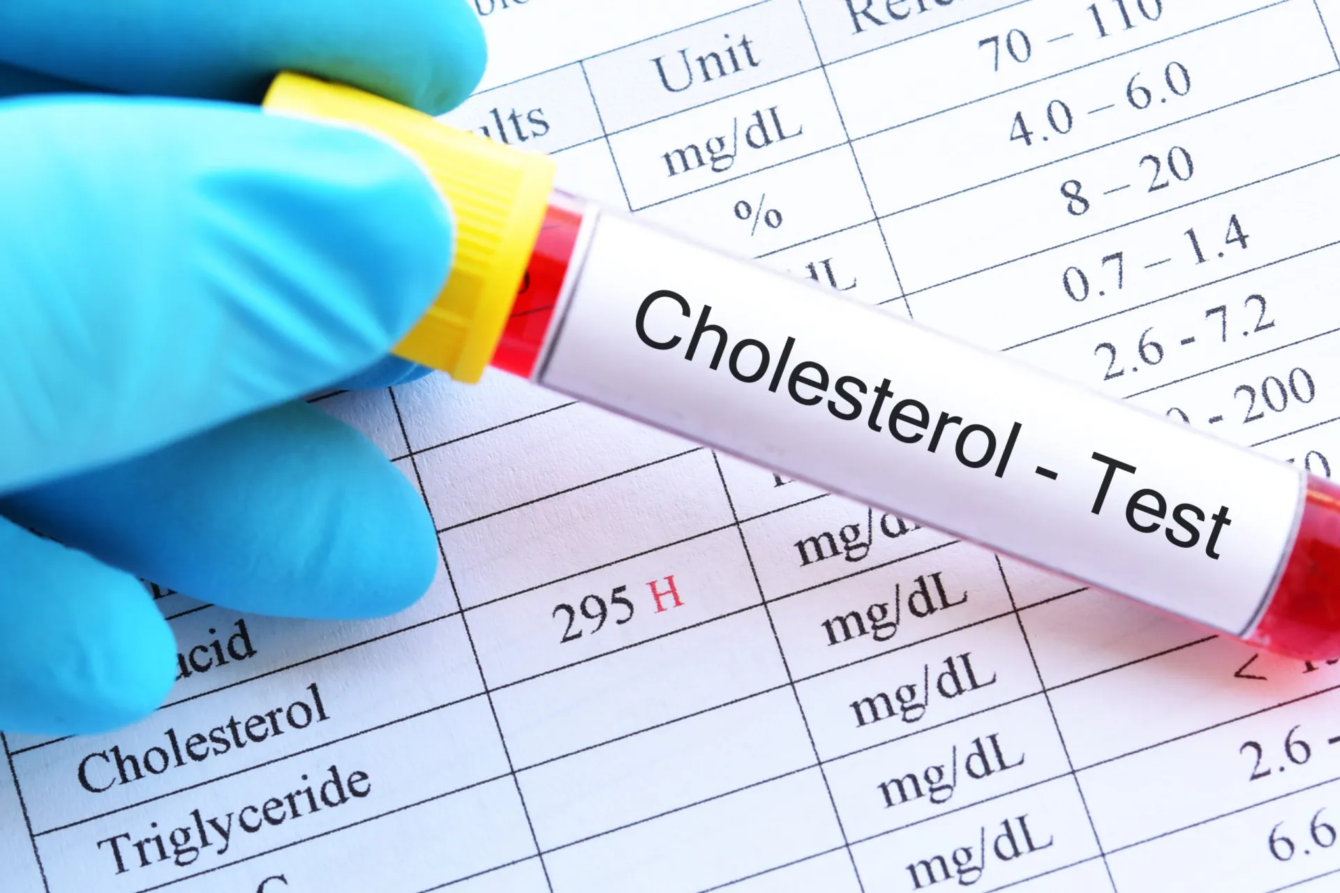 Amostra de sangue com níveis de colesterol saudáveis, resultado da prática de exercícios.