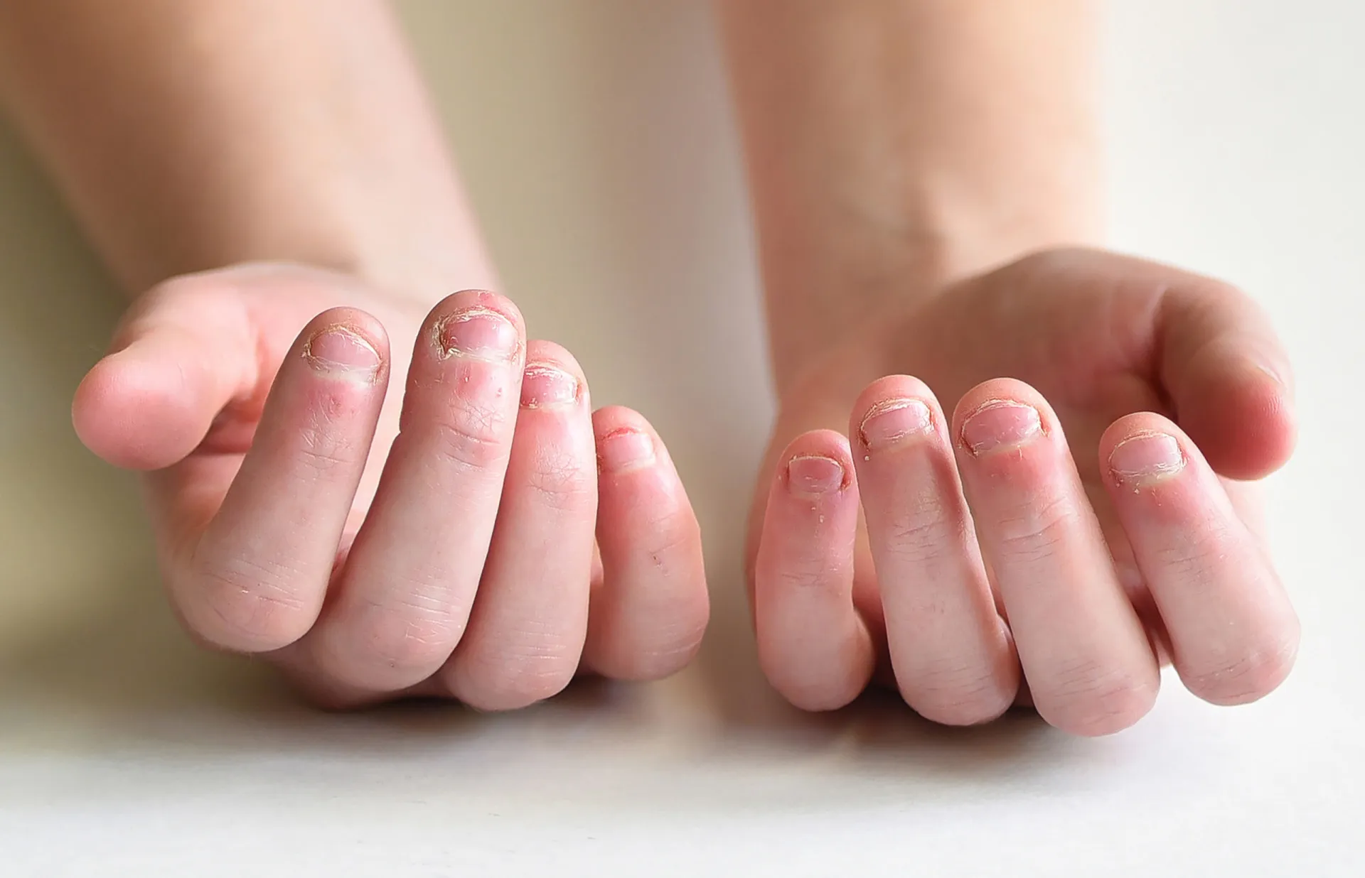Uma pessoa olhando para as próprias mãos com uma expressão de preocupação e frustração.