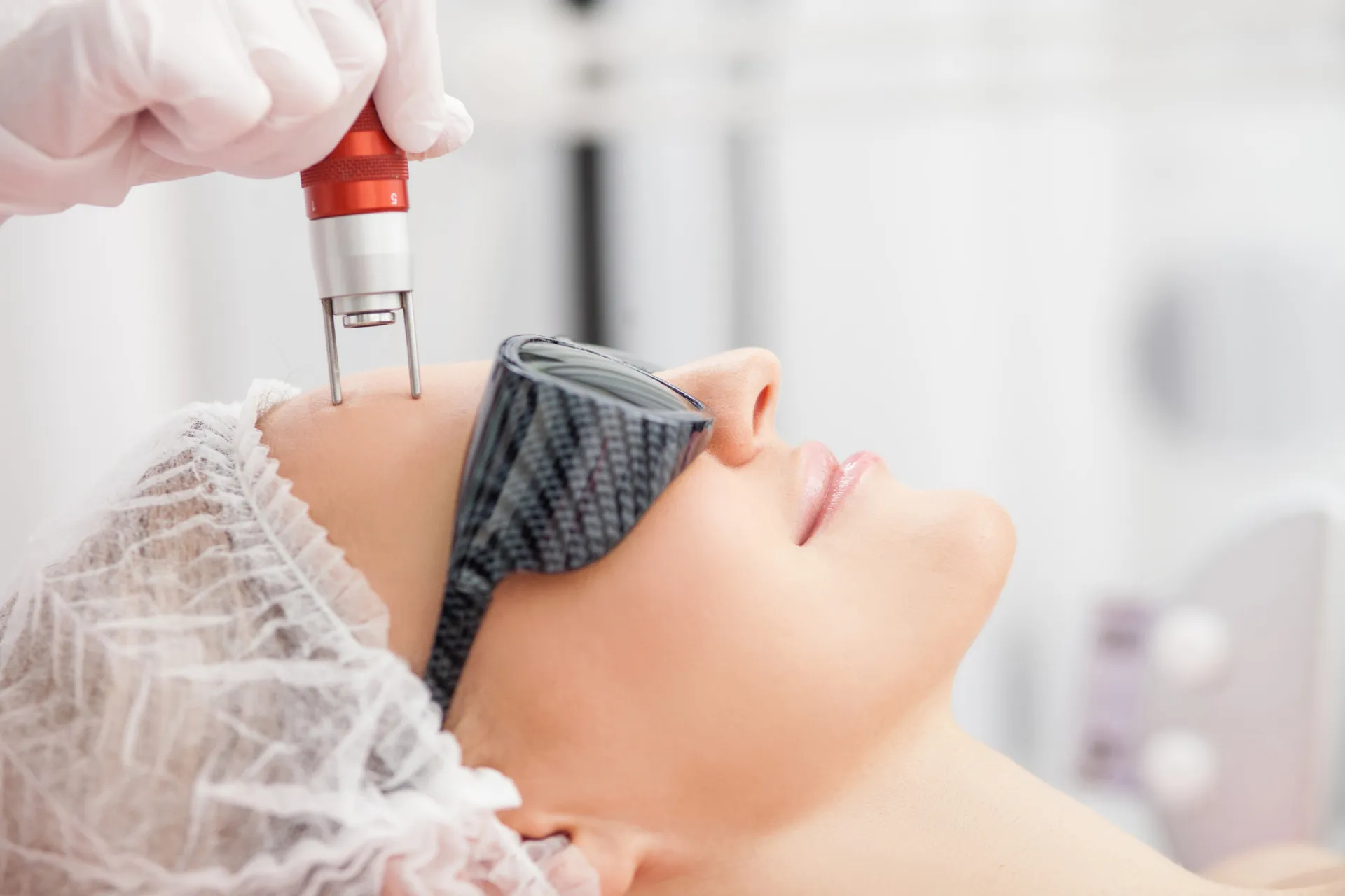 Aparelho de laser sendo usado no rosto de uma paciente para tratamento de rejuvenescimento.