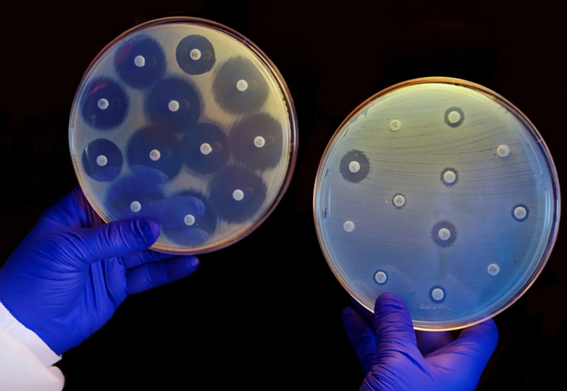Grandes tanques de fermentação de aço inoxidável em uma moderna fábrica farmacêutica.