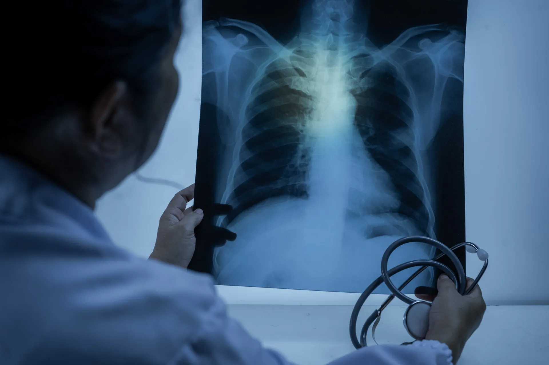 Técnico de radiologia posicionando um paciente para um exame de raio-X do tórax.