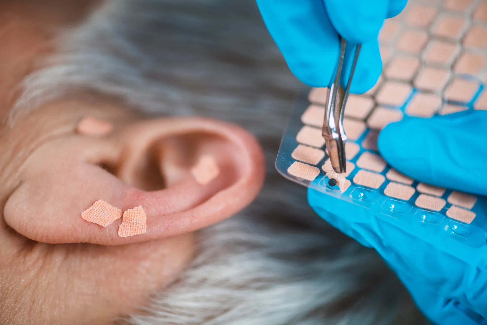 Close-up de uma semente de auriculoterapia presa à orelha com uma fita adesiva transparente.